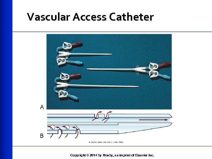 Vascular Access Catheter Copyright © 2014 by Mosby, an imprint of Elsevier Inc. 
