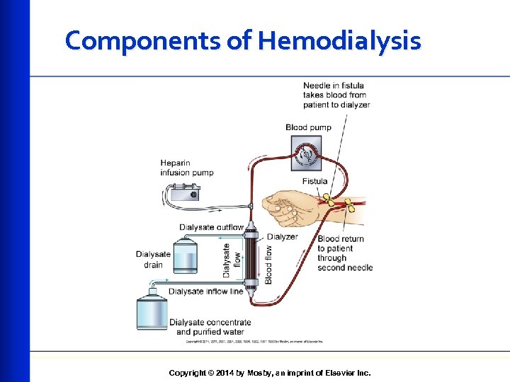 Components of Hemodialysis Copyright © 2014 by Mosby, an imprint of Elsevier Inc. 