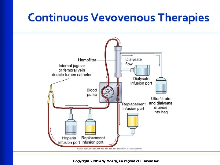 Continuous Vevovenous Therapies Copyright © 2014 by Mosby, an imprint of Elsevier Inc. 