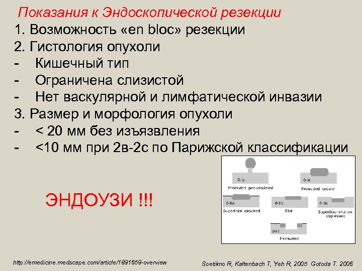  Показания к Эндоскопической резекции 1. Возможность «en bloc» резекции 2. Гистология опухоли -