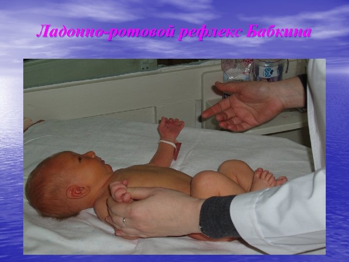Ладонно-ротовой рефлекс Бабкина 