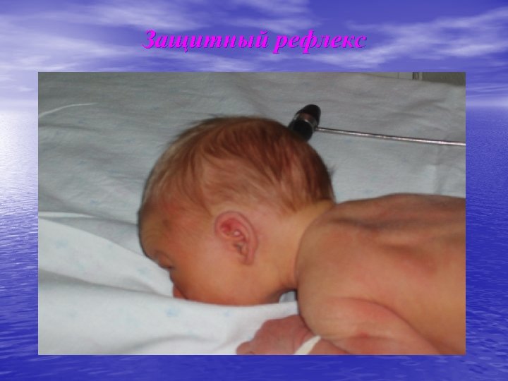 Защитный рефлекс 