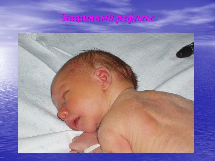 Защитный рефлекс 