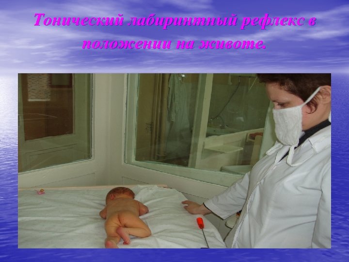 Тонический лабиринтный рефлекс в положении на животе. 