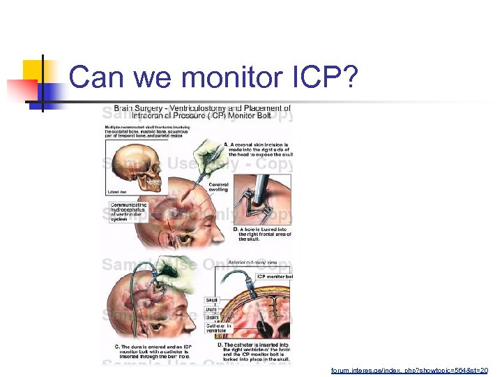 Can we monitor ICP? forum. interes. ge/index. php? showtopic=564&st=20 