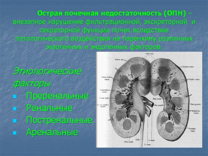 Острая почечная недостаточность (ОПН) – внезапное нарушение фильтрационной, экскреторной и секреторной функции почек вследствие