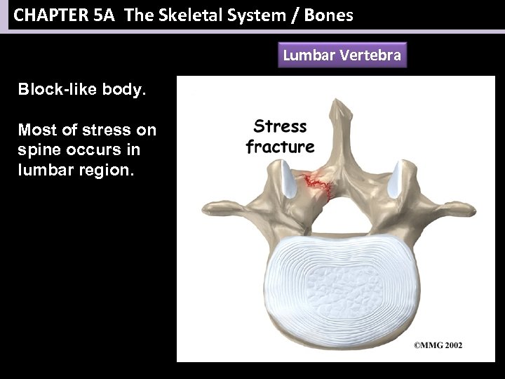 CHAPTER 5 A The Skeletal System / Bones Lumbar Vertebra Block-like body. Most of