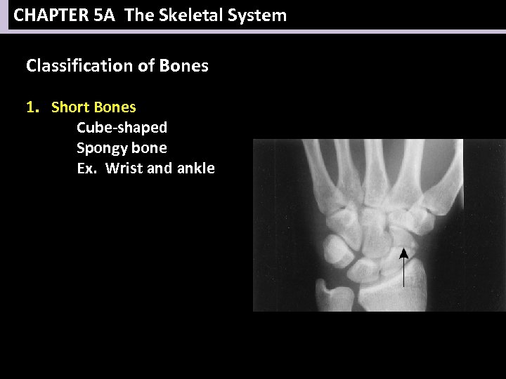 CHAPTER 5 A The Skeletal System Classification of Bones 1. Short Bones Cube-shaped Spongy