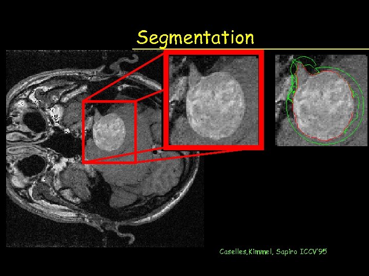 Segmentation Caselles, Kimmel, Sapiro ICCV’ 95 