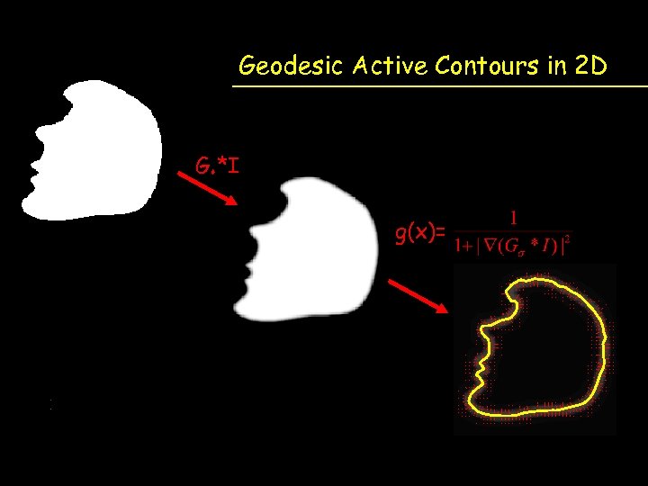 Geodesic Active Contours in 2 D Gs *I g(x)= 