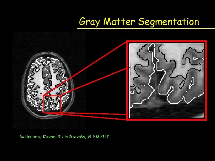 Gray Matter Segmentation Goldenberg Kimmel Rivlin Rudzsky, VLSM 2001 