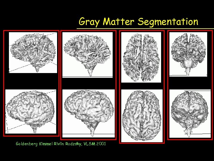 Gray Matter Segmentation Goldenberg Kimmel Rivlin Rudzsky, VLSM 2001 