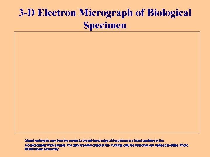 3 -D Electron Micrograph of Biological Specimen Object making its way from the center