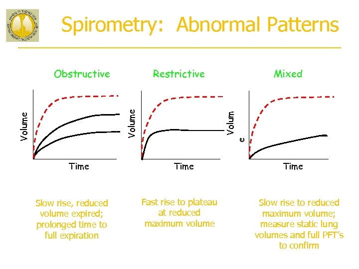 Spirometry: Abnormal Patterns Restrictive Time Slow rise, reduced volume expired; prolonged time to full