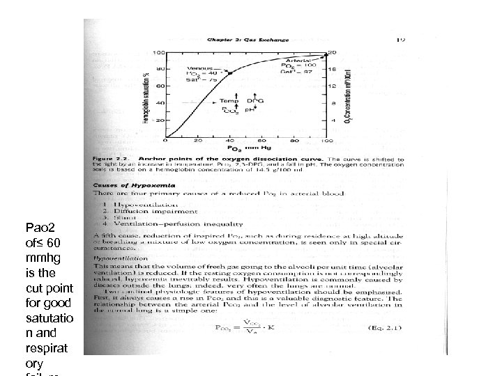 Pao 2 of≤ 60 mmhg is the cut point for good satutatio n and