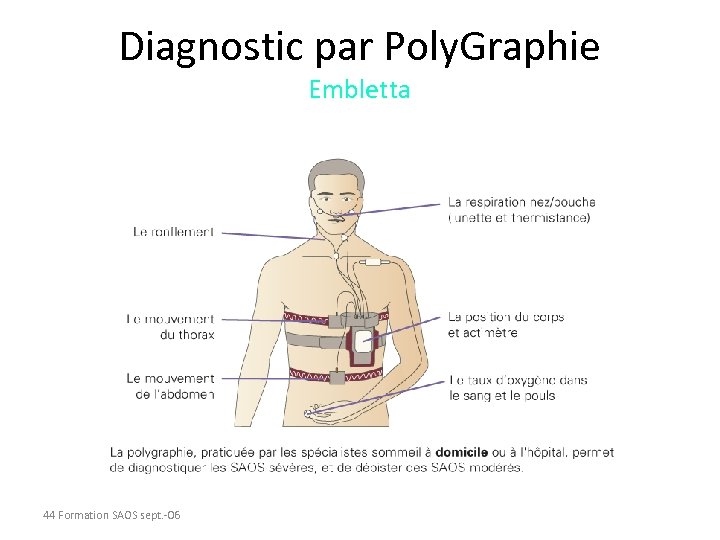 Diagnostic par Poly. Graphie Embletta 44 Formation SAOS sept. -06 