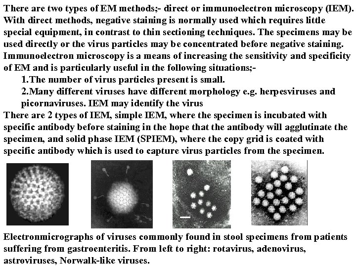 There are two types of EM methods; - direct or immunoelectron microscopy (IEM). With