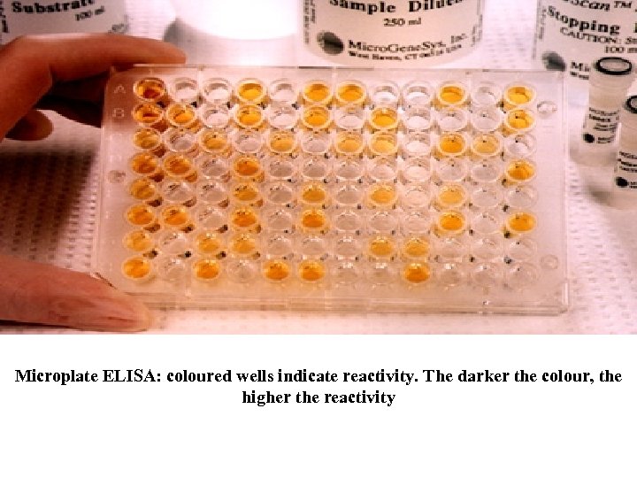 Microplate ELISA: coloured wells indicate reactivity. The darker the colour, the higher the reactivity