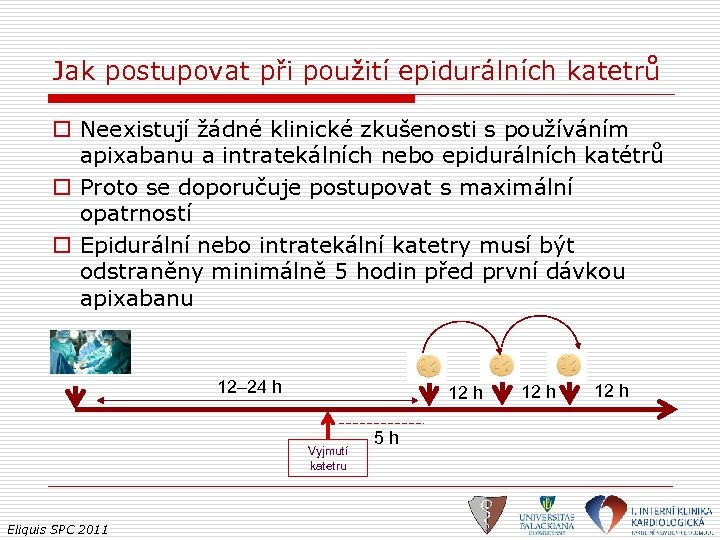 Jak postupovat při použití epidurálních katetrů o Neexistují žádné klinické zkušenosti s používáním apixabanu