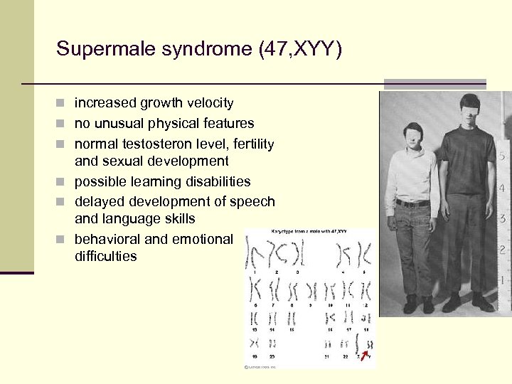 Supermale syndrome (47, XYY) n increased growth velocity n no unusual physical features n