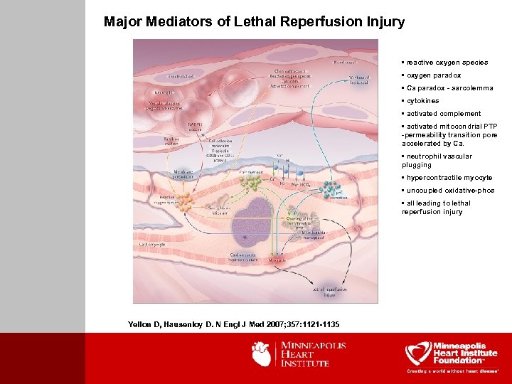 Major Mediators of Lethal Reperfusion Injury • reactive oxygen species • oxygen paradox •