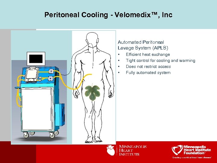 Peritoneal Cooling - Velomedix™, Inc Automated Peritoneal Lavage System (APLS) • • Efficient heat