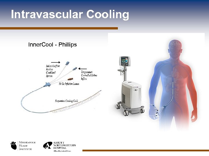 Intravascular Cooling Inner. Cool - Phillips 