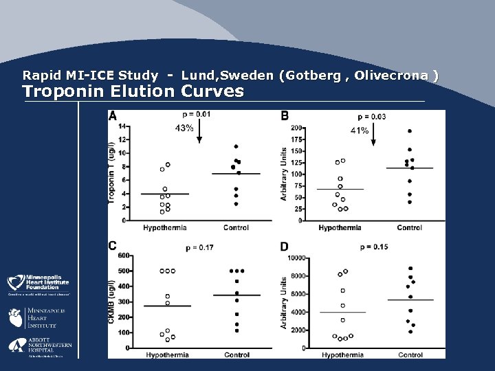 Rapid MI-ICE Study - Lund, Sweden (Gotberg , Olivecrona ) Troponin Elution Curves 