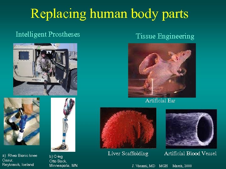 Replacing human body parts Intelligent Prostheses Tissue Engineering Artificial Ear a) Rheo Bionic knee