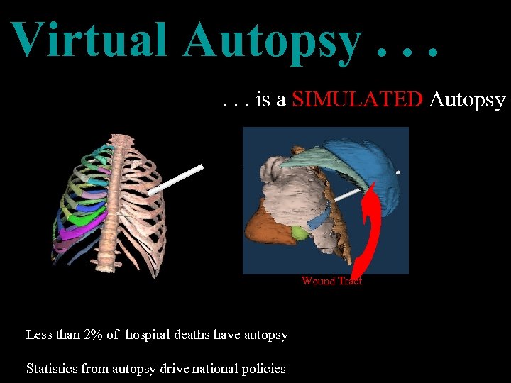 Virtual Autopsy. . . is a SIMULATED Autopsy Wound Tract Less than 2% of