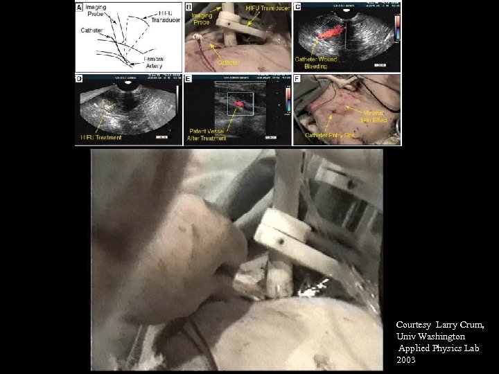 Courtesy Larry Crum, Univ Washington Applied Physics Lab 2003 