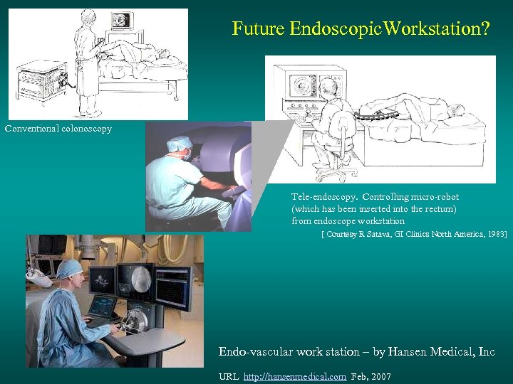 Future Endoscopic. Workstation? Conventional colonoscopy Tele-endoscopy. Controlling micro-robot (which has been inserted into the