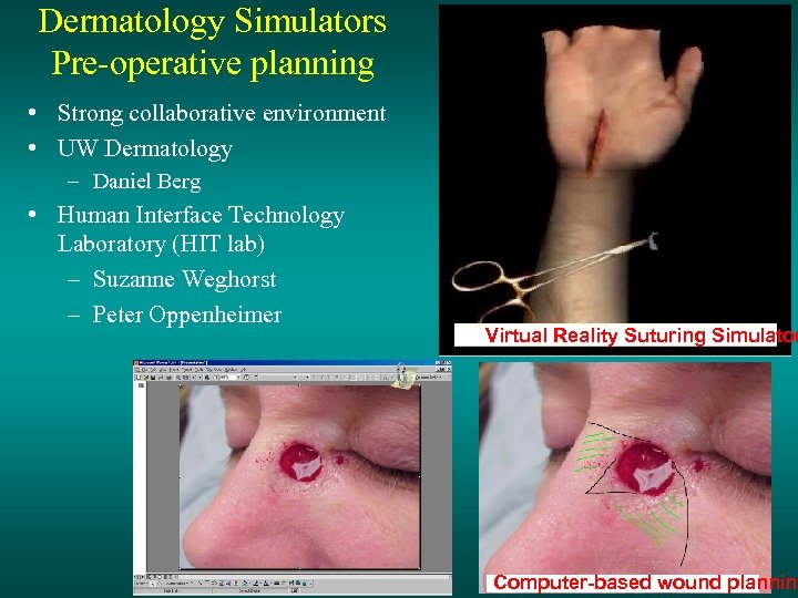 Dermatology Simulators Pre-operative planning • Strong collaborative environment • UW Dermatology – Daniel Berg