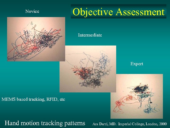 Novice Objective Assessment Intermediate Expert MEMS based tracking, RFID, etc Hand motion tracking patterns