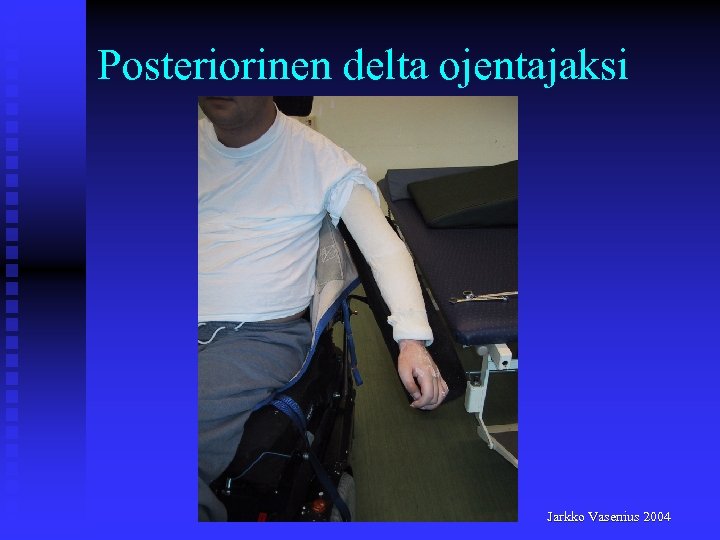 Posteriorinen delta ojentajaksi Jarkko Vasenius 2004 