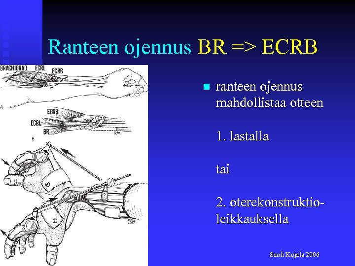 Ranteen ojennus BR => ECRB n ranteen ojennus mahdollistaa otteen 1. lastalla tai 2.