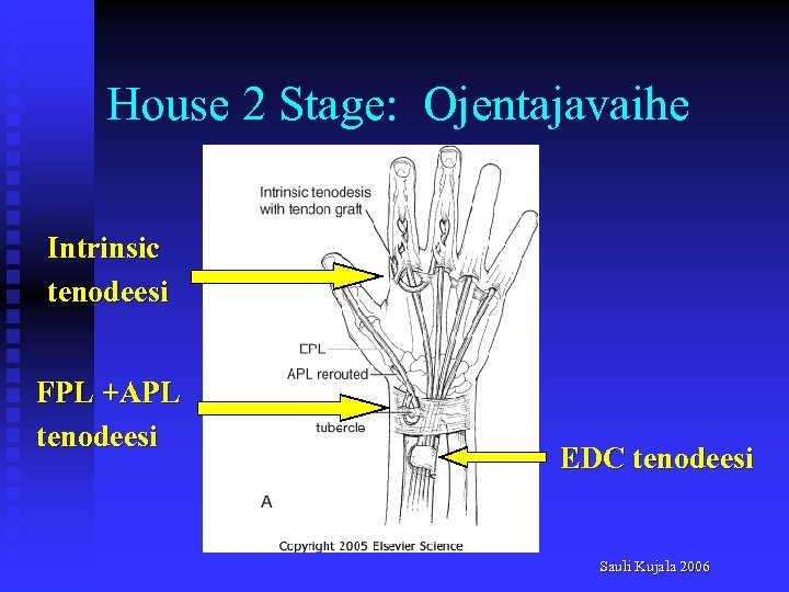 House 2 Stage: Ojentajavaihe Intrinsic tenodeesi FPL +APL tenodeesi EDC tenodeesi Sauli Kujala 2006