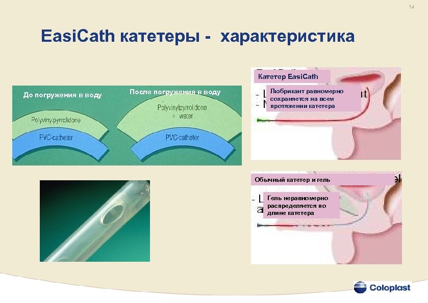 14 Easi. Cath катетеры - характеристика Катетер Easi. Cath До погружения в воду После