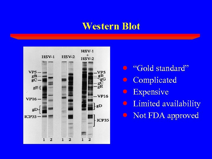 Western Blot · · · “Gold standard” Complicated Expensive Limited availability Not FDA approved