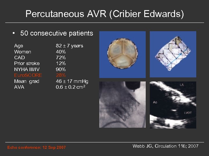Percutaneous AVR (Cribier Edwards) • 50 consecutive patients Age Women CAD Prior stroke NYHA