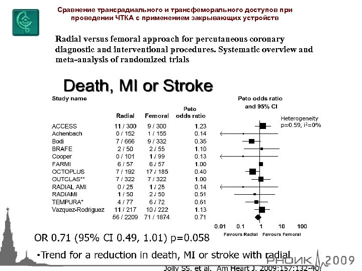 Сравнение трансрадиального и трансфеморального доступов при проведении ЧТКА с применением закрывающих устройств Radial versus