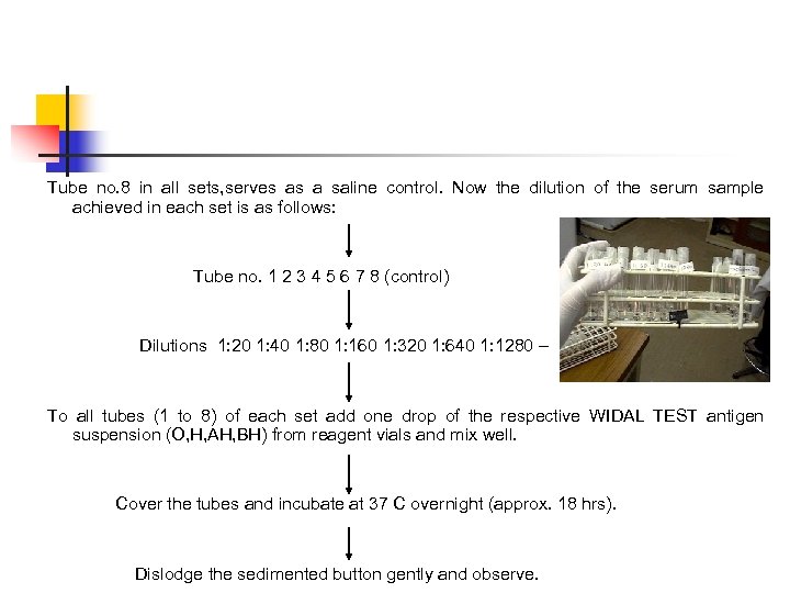 Tube no. 8 in all sets, serves as a saline control. Now the dilution