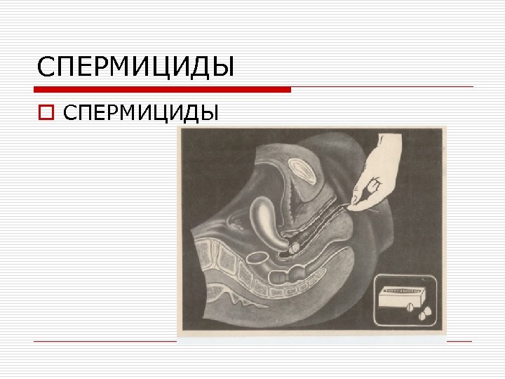 СПЕРМИЦИДЫ o СПЕРМИЦИДЫ 