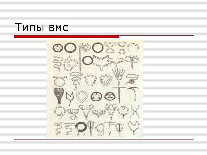 Типы вмс 