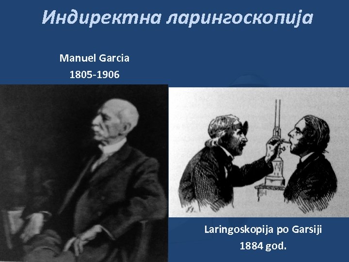 Индиректна ларингоскопија Manuel Garcia 1805 -1906 Laringoskopija po Garsiji 1884 god. 