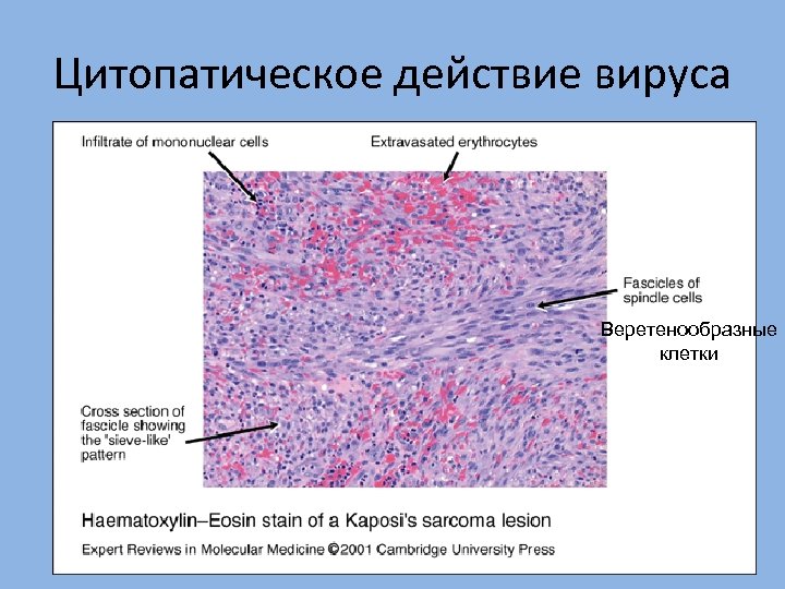Цитопатическое действие вируса Веретенообразные клетки 