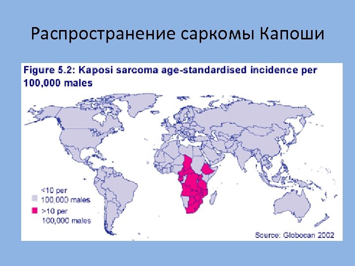 Распространение саркомы Капоши 