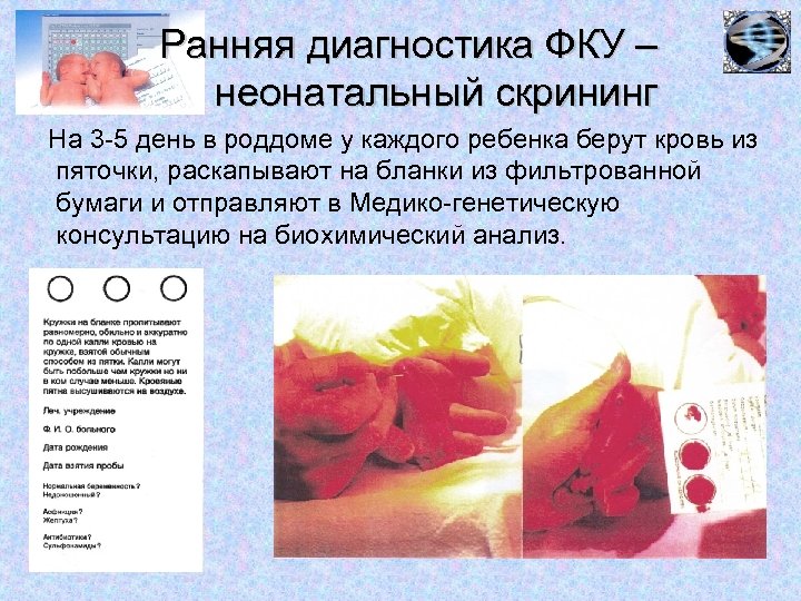 Ранняя диагностика ФКУ – неонатальный скрининг На 3 -5 день в роддоме у каждого