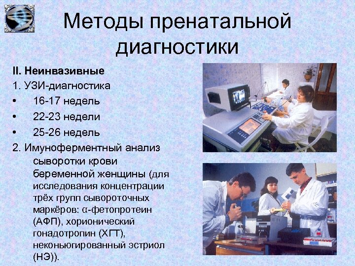 Методы пренатальной диагностики II. Неинвазивные 1. УЗИ-диагностика • 16 -17 недель • 22 -23