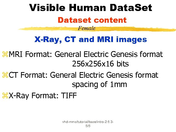 Visible Human Data. Set Dataset content Female X-Ray, CT and MRI images z. MRI